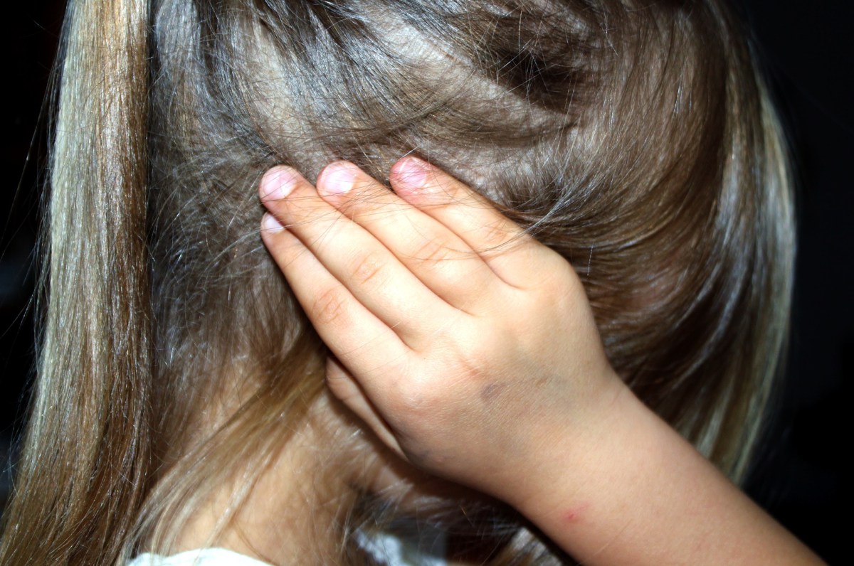 Young girl with hand over hear ear. Tinnitus concept.
