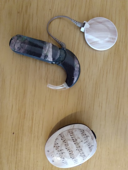 Cochlear implant processor and Rondo2.