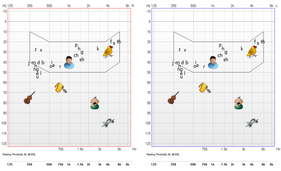 Beyond the Circles and Crosses: Understanding Your Audiogram – Sudden ...